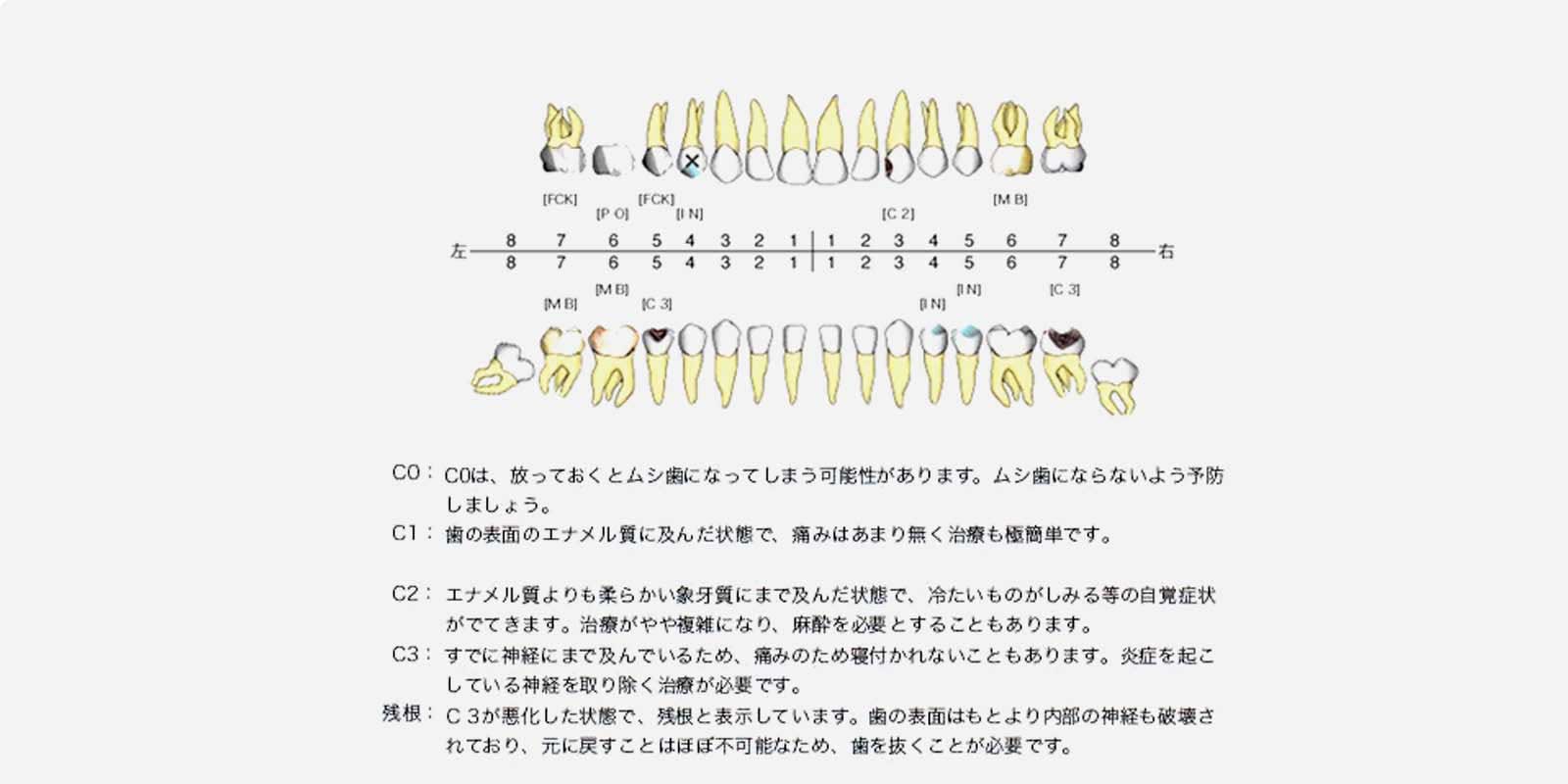 ムシ歯診断書