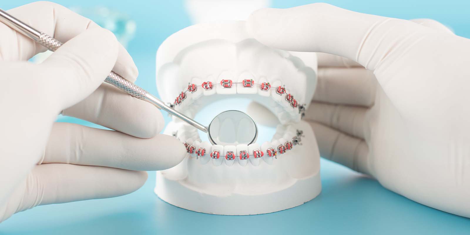 当院の矯正歯科について
